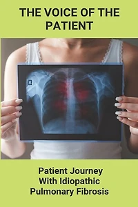 The Voice Of The Patient: Patient Journey With Idiopathic Pulmonary Fibrosis: New Mountains To Climb
