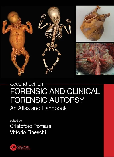 Forensic and Clinical Autopsy: An Atlas Handbook