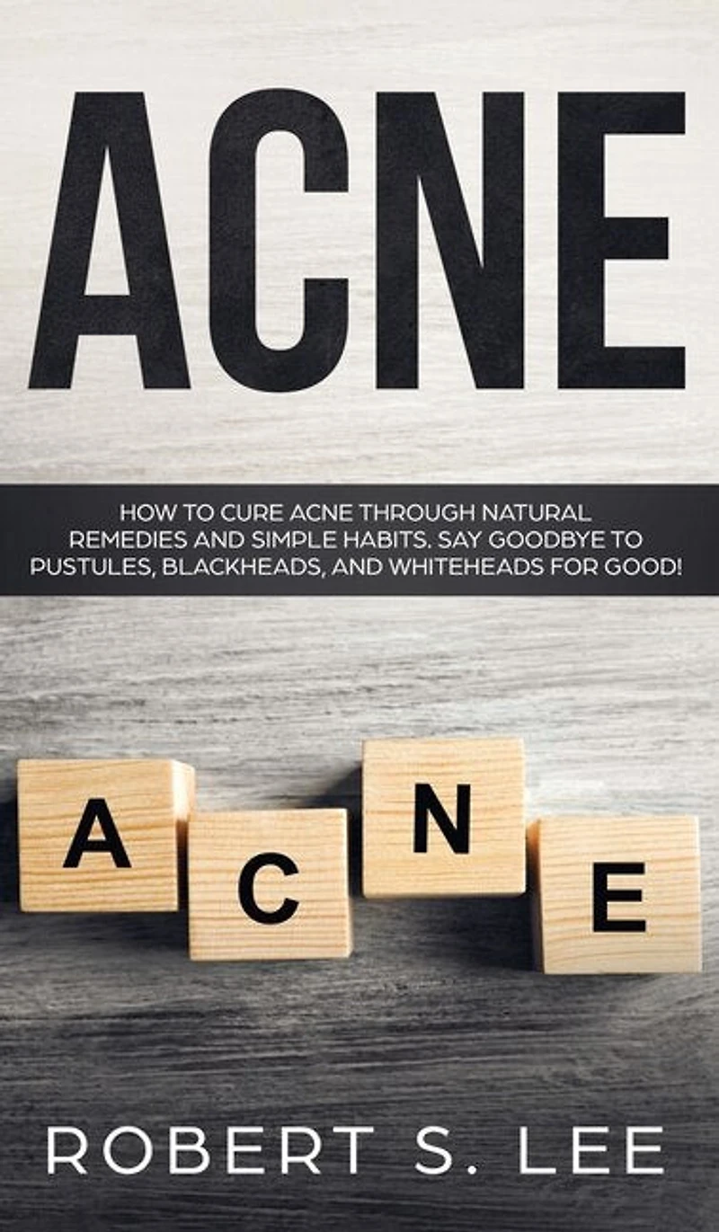 Acne: How to Cure Acne through Natural Remedies and Simple Habits. Say Goodbye Pustules, Blackheads Whiteheads for Good!