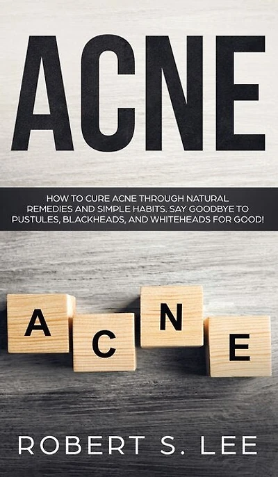 Acne: How to Cure Acne through Natural Remedies and Simple Habits. Say Goodbye Pustules, Blackheads Whiteheads for Good!