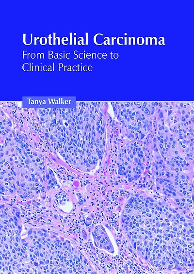 Urothelial Carcinoma: From Basic Science to Clinical Practice