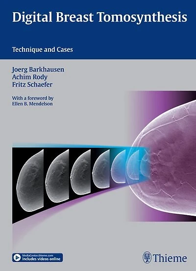 Digital Breast Tomosynthesis: Technique And Cases