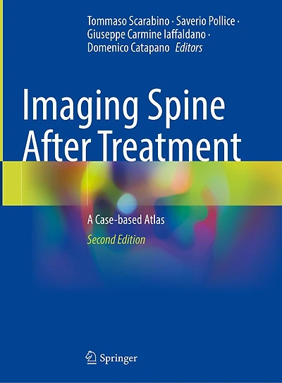 Imaging Spine After Treatment: A Case-based Atlas
