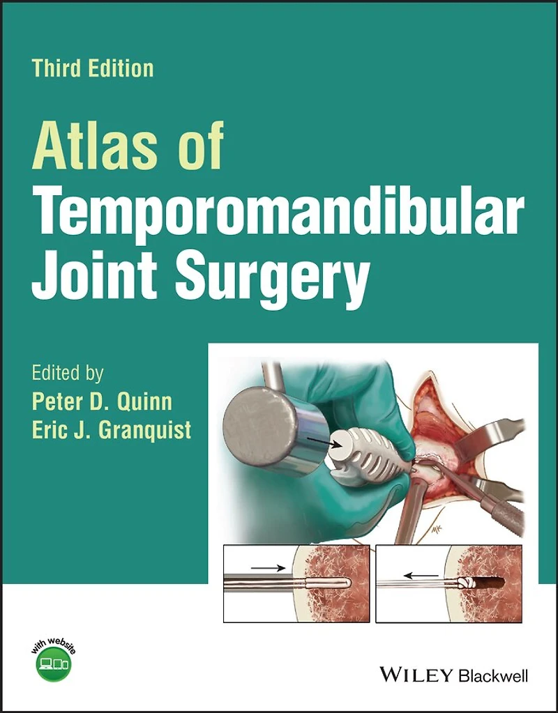 Atlas of Temporomandibular Joint Surgery