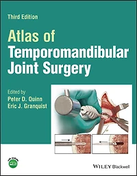 Atlas of Temporomandibular Joint Surgery