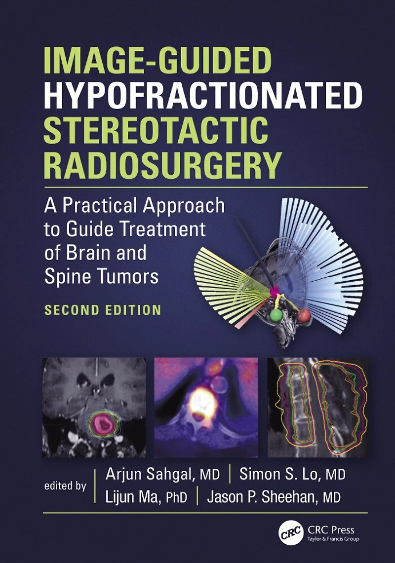 Image-Guided Hypofractionated Stereotactic Radiosurgery: A Practical Approach to Guide Treatment of Brain and Spine Tumo: Tumors