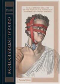 Crucial Interventions: An Illustrated Treatise of the Principles&Practice 19th Century Surgery