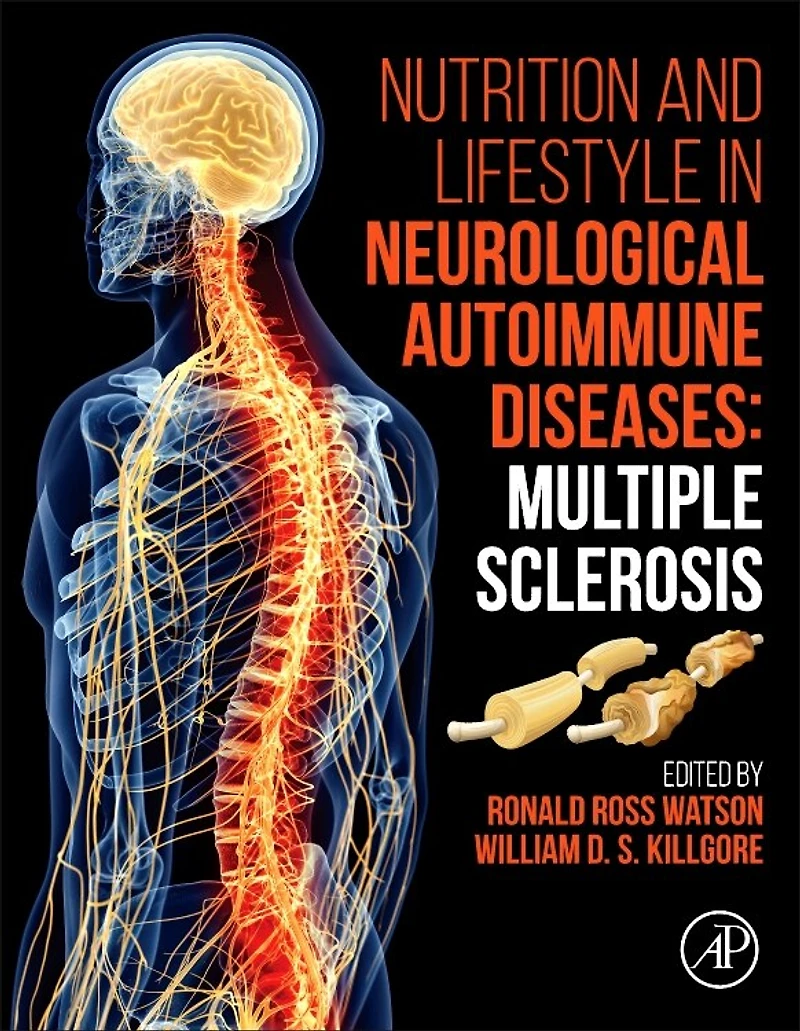 Nutrition and Lifestyle Neurological Autoimmune Diseases: Multiple Sclerosis