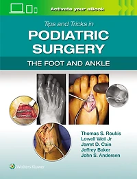 Tips and Tricks Podiatric Surgery: The Foot Ankle: Print + eBook with Multimedia