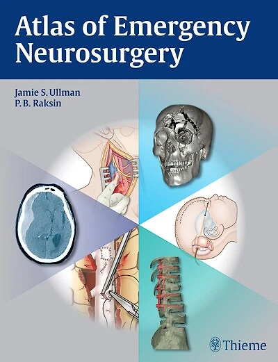 Atlas Of Emergency Neurosurgery