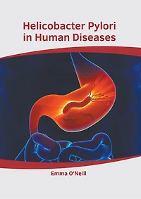 Helicobacter Pylori In Human Diseases