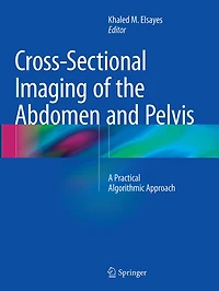 Cross-sectional Imaging Of The Abdomen And Pelvis: A Practical Algorithmic Approach