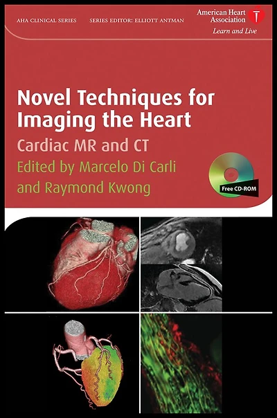Novel Techniques for Imaging the Heart: Cardiac MR and CT