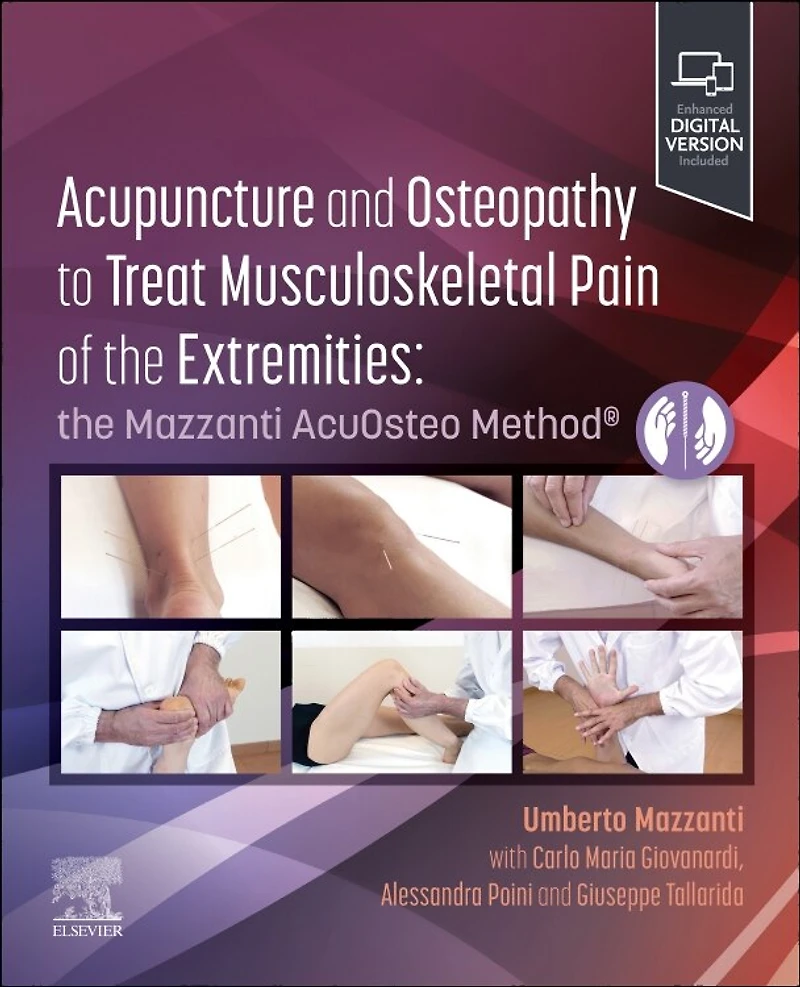 Acupuncture and Osteopathy to Treat Musculoskeletal Pain of the Extremities: Mazzanti AcuOsteo Method