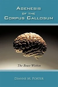 Agenesis Of The Corpus Callosum: Beast Within