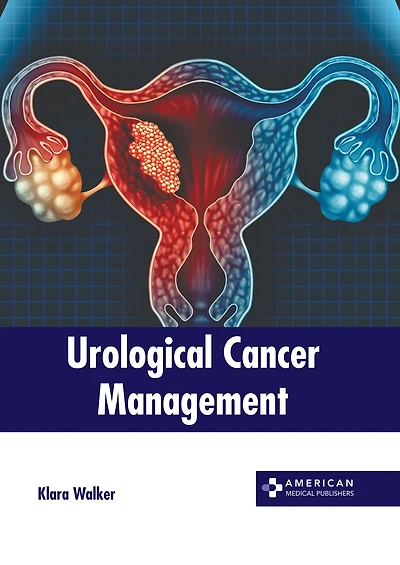 Urological Cancer Management