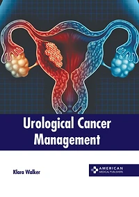 Urological Cancer Management