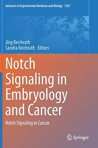 Notch Signaling Embryology And Cancer: Cancer