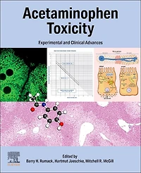 Acetaminophen Toxicity: Experimental and Clinical Advances