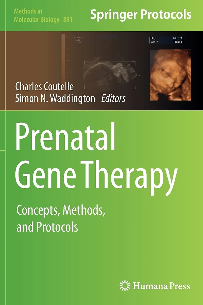 Prenatal Gene Therapy: Concepts, Methods, And Protocols