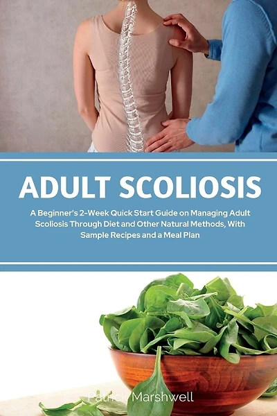 Adult Scoliosis: A Beginner's 2-Week Quick Start Guide on Managing Adult Scoliosis Through Diet and Other Natural Methods, With Sample Recipes and a Meal Plan