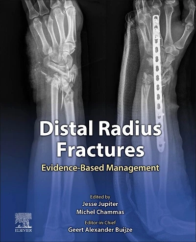 Distal Radius Fractures: Evidence-based Management