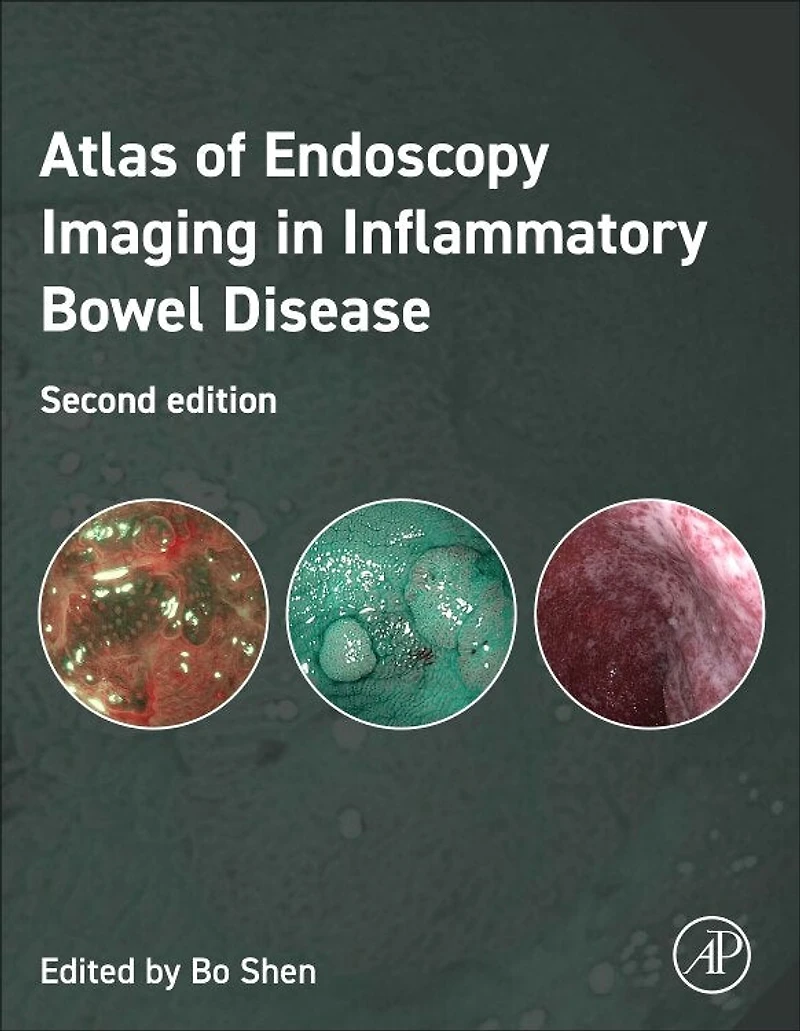 Atlas of Endoscopy Imaging Inflammatory Bowel Disease