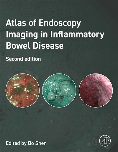 Atlas of Endoscopy Imaging Inflammatory Bowel Disease