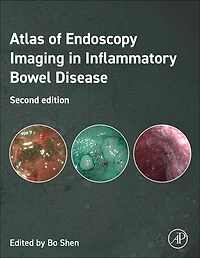 Atlas of Endoscopy Imaging Inflammatory Bowel Disease