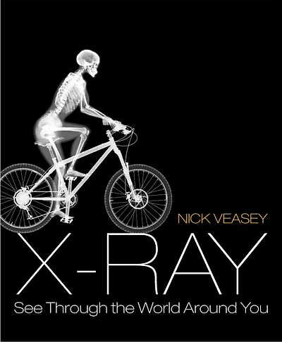 X Ray