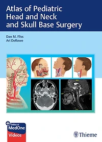 Atlas Of Pediatric Head And Neck Skull Base Surgery