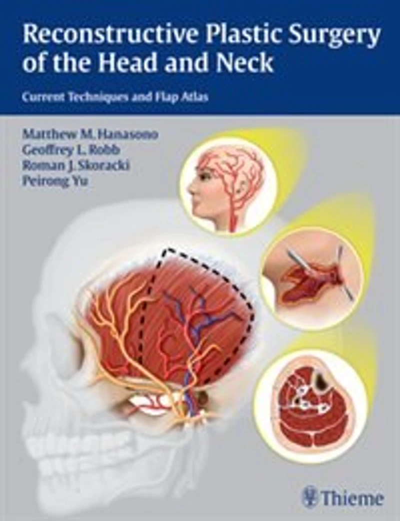 Reconstructive Plastic Surgery Of The Head And Neck: Current Techniques Flap Atlas