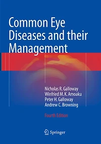 Common Eye Diseases and their Management