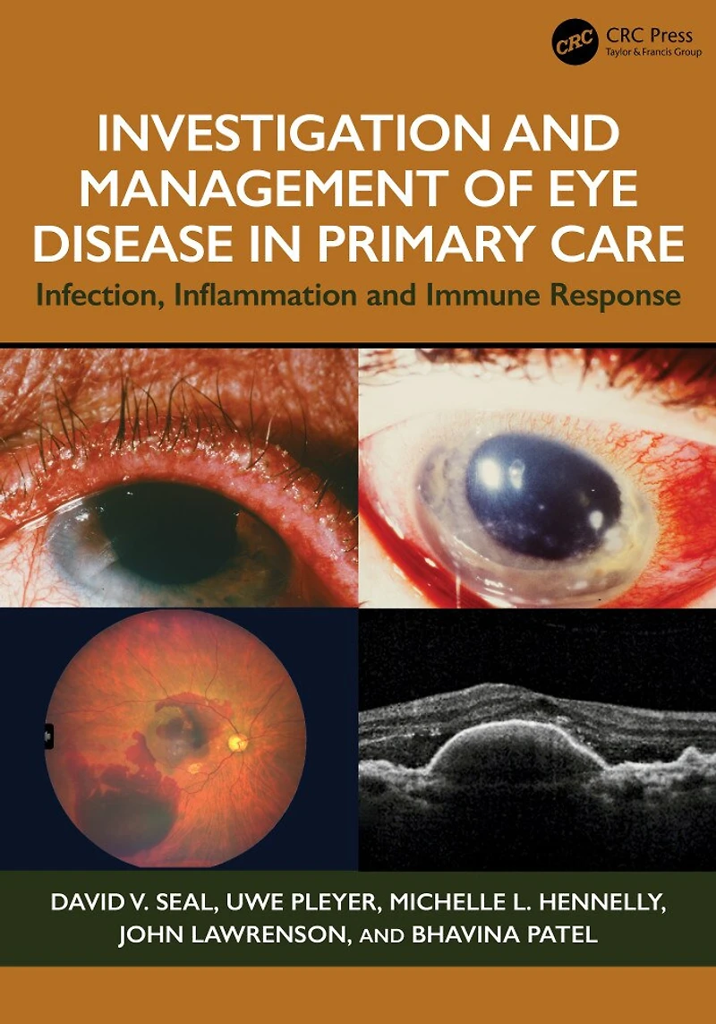Investigation and Management of Eye Disease Primary Care: Infection, Inflammation Immune Response