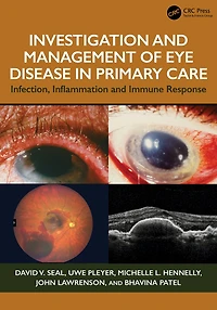 Investigation and Management of Eye Disease Primary Care: Infection, Inflammation Immune Response