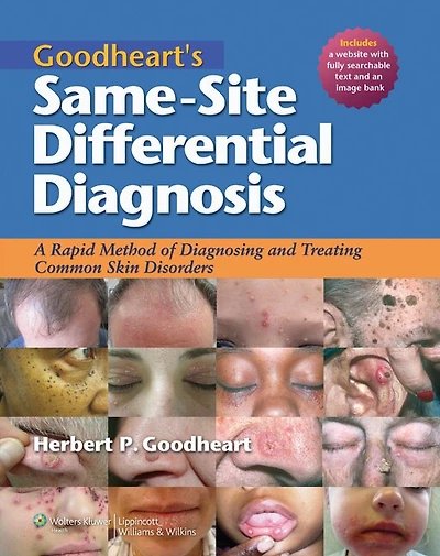 Goodheart's Same-Site Differential Diagnosis: Dermatology for the Primary Health Care Provider