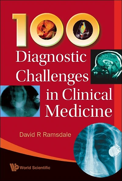 100 Diagnostic Challenges Clinical Medicine