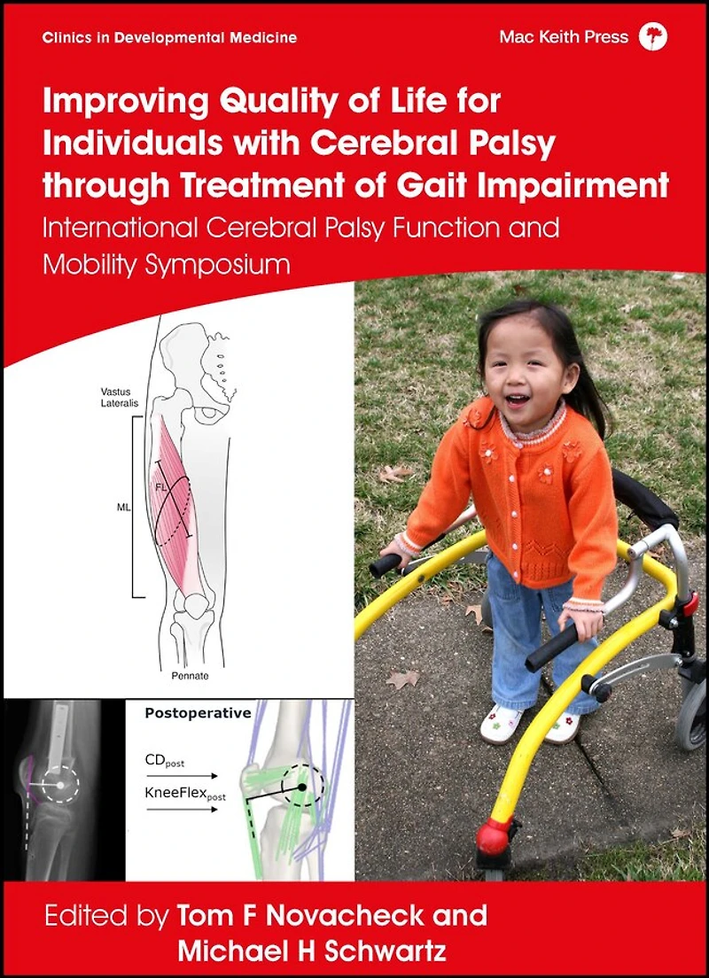 Improving Quality of Life for Individuals with Cerebral Palsy through Treatment Gait Impairment: International Function and Mobility