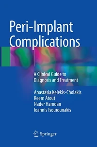 Peri-implant Complications: A Clinical Guide To Diagnosis And Treatment