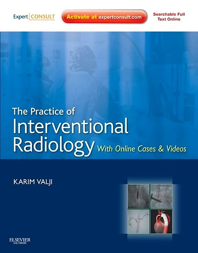 The Practice of Interventional Radiology, with Online cases and video: Expert Consult Premium Edition - Enhanced Features Print, 1e