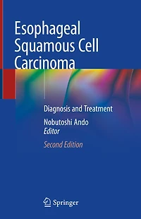 Esophageal Squamous Cell Carcinoma: Diagnosis And Treatment