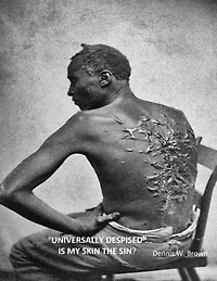Universally Despised" Is My Skin the Sin