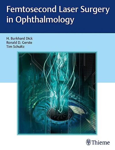 Femtosecond Laser Surgery Ophthalmology