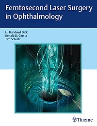 Femtosecond Laser Surgery Ophthalmology