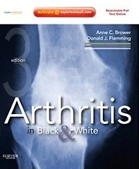 Arthritis in Black and White: Expert Consult - Online and Print