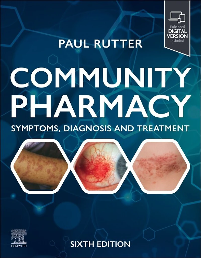 Community Pharmacy: Symptoms, Diagnosis and Treatment: Treatment