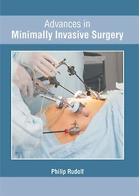 Advances In Minimally Invasive Surgery