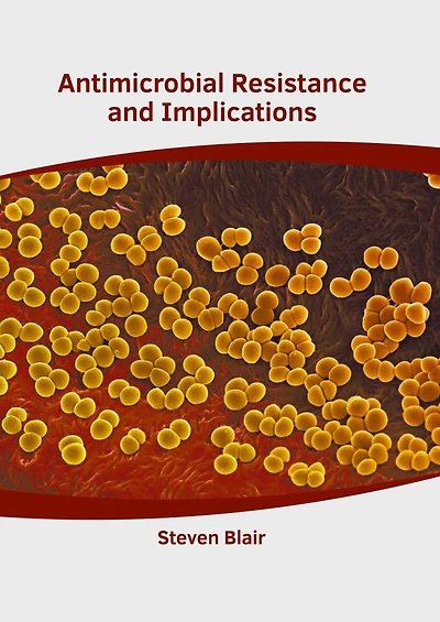 Antimicrobial Resistance And Implications
