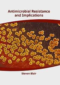 Antimicrobial Resistance And Implications