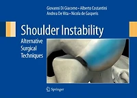 Shoulder Instability: Alternative Surgical Techniques